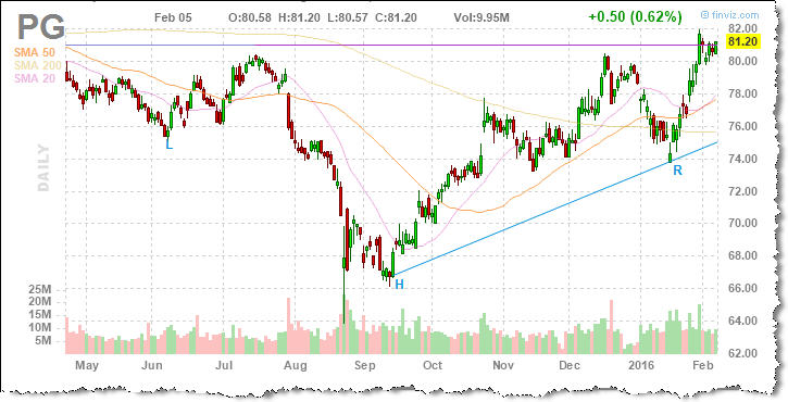 example head and shoulders